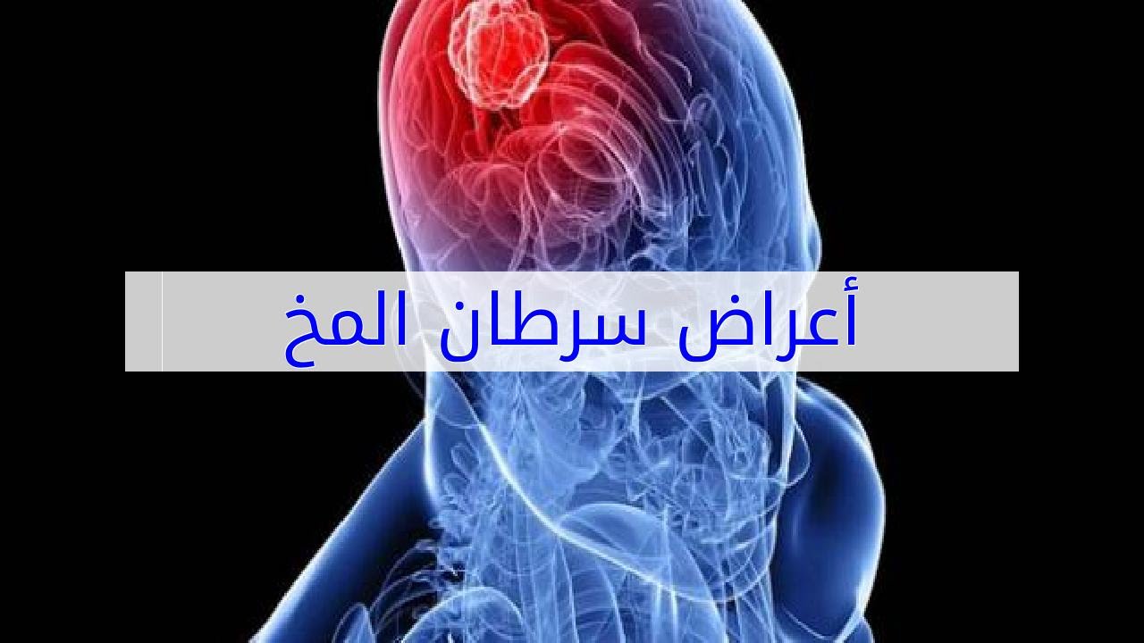 اعراض سرطان الدماغ - واهم طرق علاجه 4699