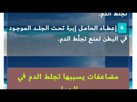 تخثر الدم عند الحامل - الحامل والاصابات التى يمكن ان تتعرض لها 15970 1