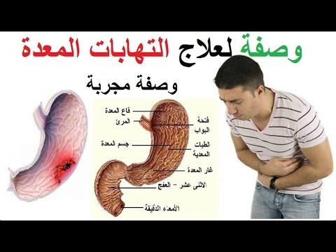 جرثومة المعدة وعلاجها , اعراض جرثومة المعدة والوقاية منها