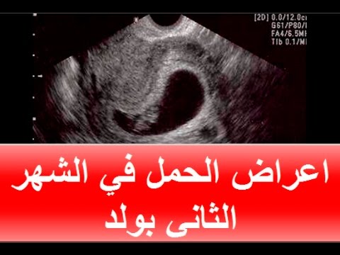 علامات الحمل بولد في الشهر الثاني - كيف تعرفين انك حامل في ولد وانت في الشهر الثاني 422