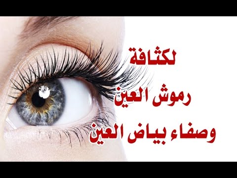 مرض يصيب العينين فما هو - الامراض التي تؤثر على العين احذر منه 15752 1