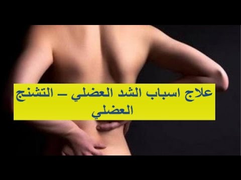 اسباب تشنج العضلات - علاج التشجن من العضلات 15275 1