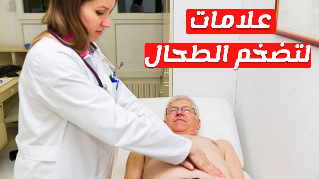 تضخم الطحال , علامات تضخم الطحال