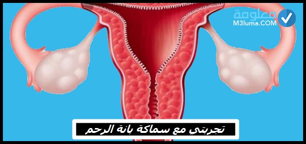 تجربتي مع سماكة بطانة الرحم , اهم ما قيل عن سماكة بطانة الرحم