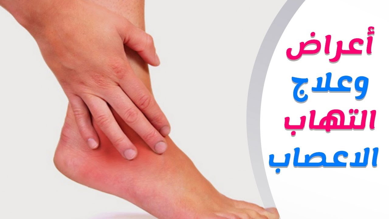 علاج الاعصاب - طريقة تقوية الاعصاب و اسباب ضعفها 3814 2