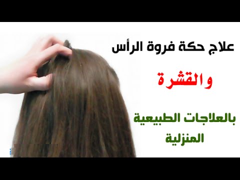 ما هو علاج قشرة الشعر - اسباب القشرة داخل الشعر 16047 2